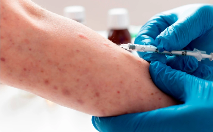 Allergy Testing in Lawrenceville